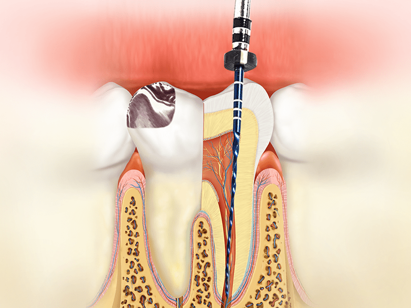 Conservative Dentistry and Endodontics SmarTeach