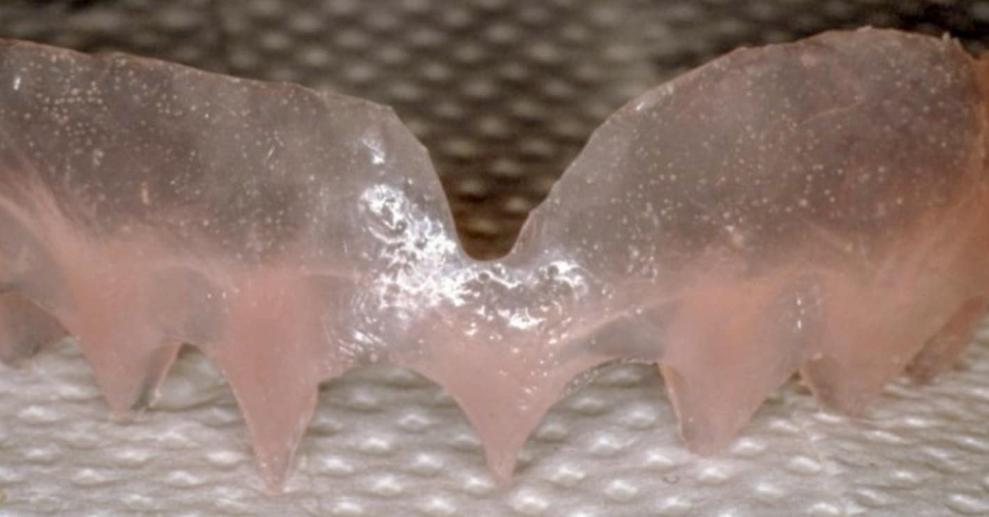 Gingival Veneers London, Enquire About Gingival Veneers Now