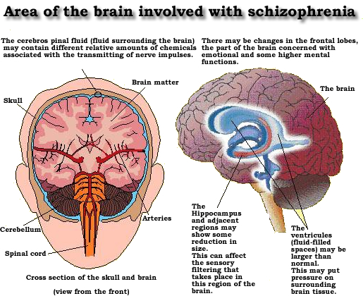 Schizophrenia! Jassiemhay