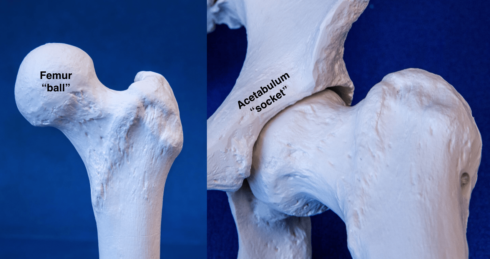 Hip Impingement Treatment North Hollywood Los Angeles Orthopedic Surgeon