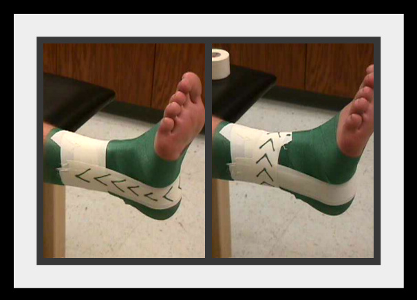 How To Tape An Ankle