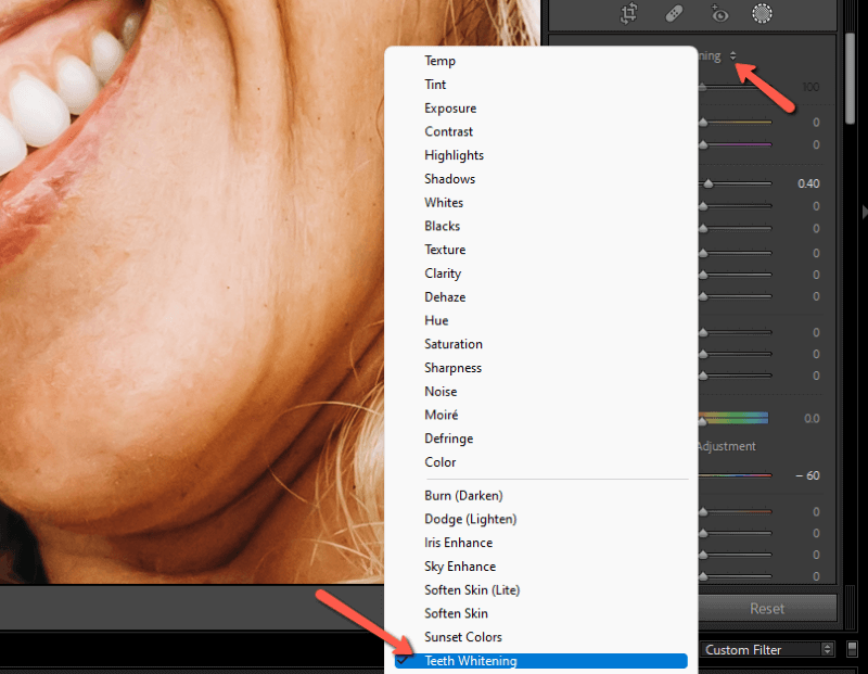 How to Whiten Teeth in Adobe Lightroom (4 Easy Steps)