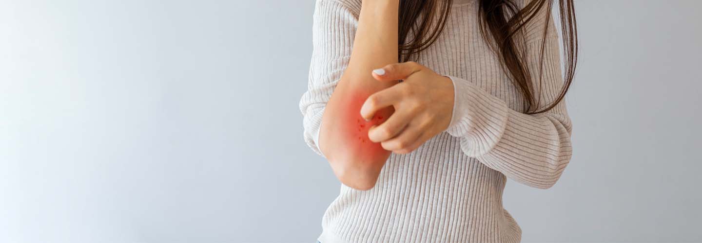 SGX302 Plaque Psoriasis Treatment for mild to moderate psoriasis