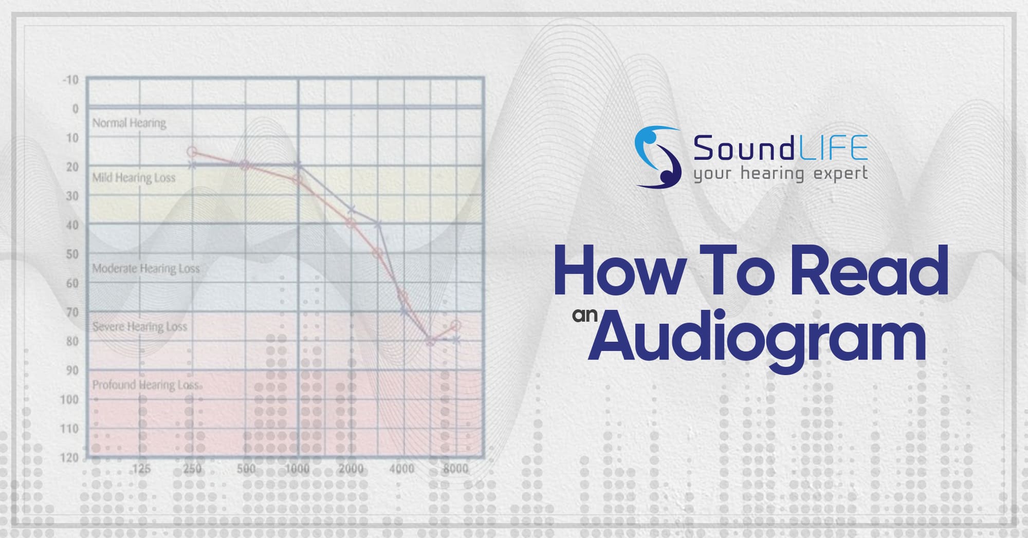 How To Read An Audiogram Asha / How To Read An Audiogram Wikihow The