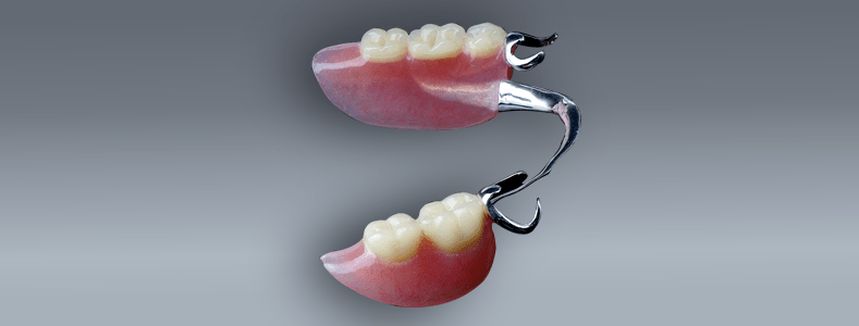 Removable Cast Partial Dentures South Calgary Denture & Implant Clinic
