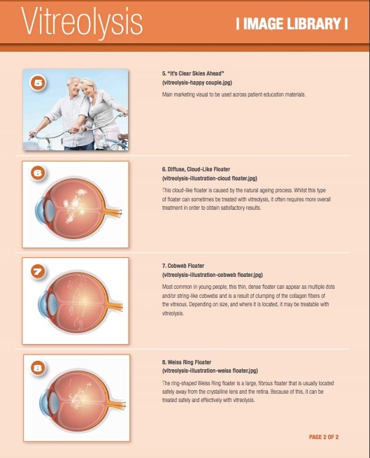 Laser Floater Treatment Chesapeake VA Eye Floater Treatment