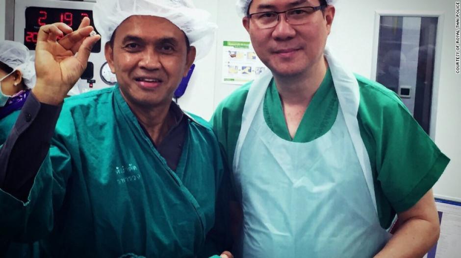 Médicos operan a una mujer para extraerle un diamante que