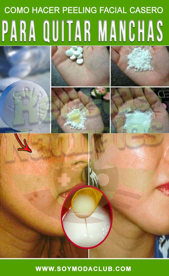 Como hacer peeling facial casero con aspirina para quitar manchas y