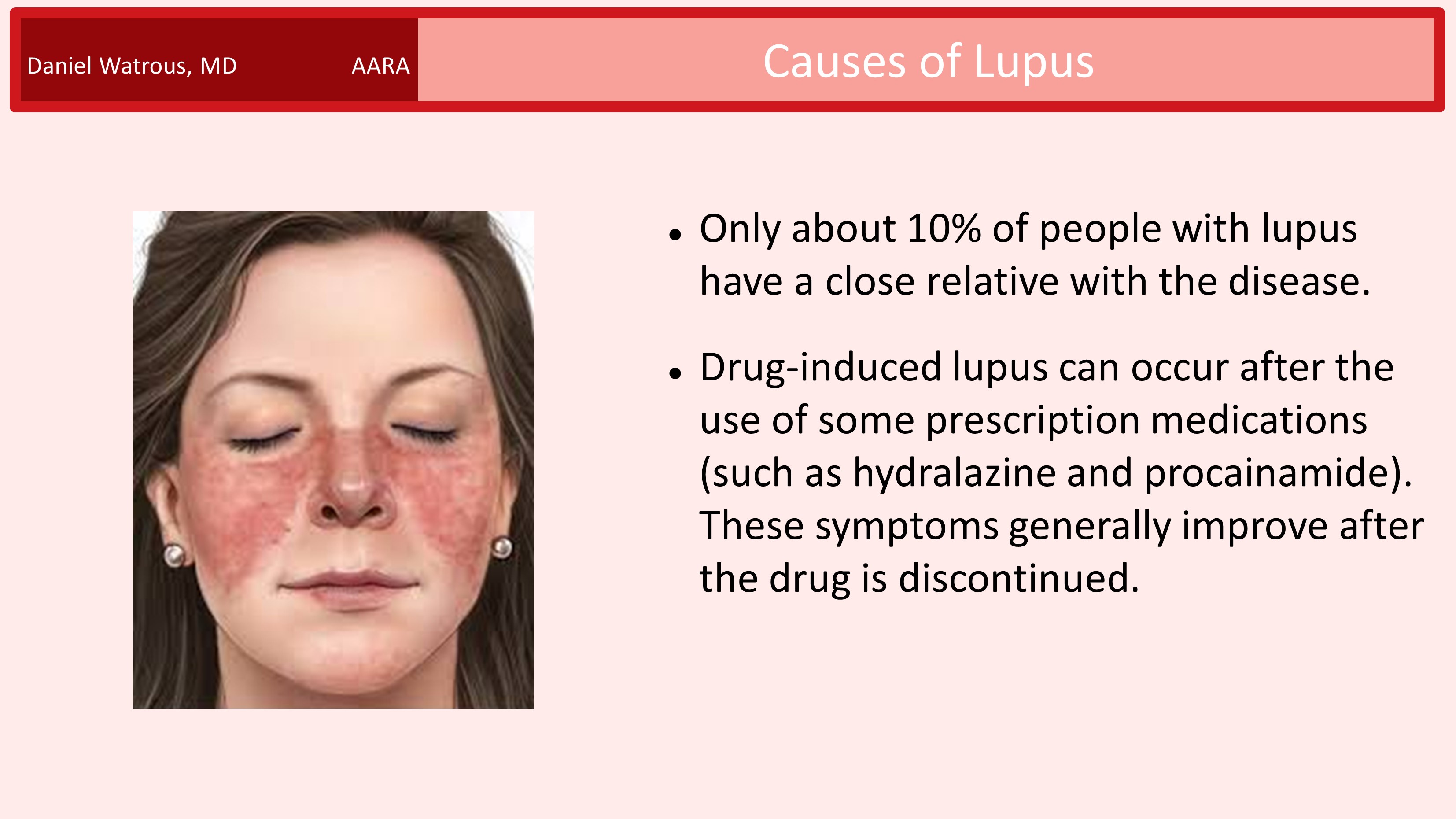 Lupus - Sierra Pacific Arthritis