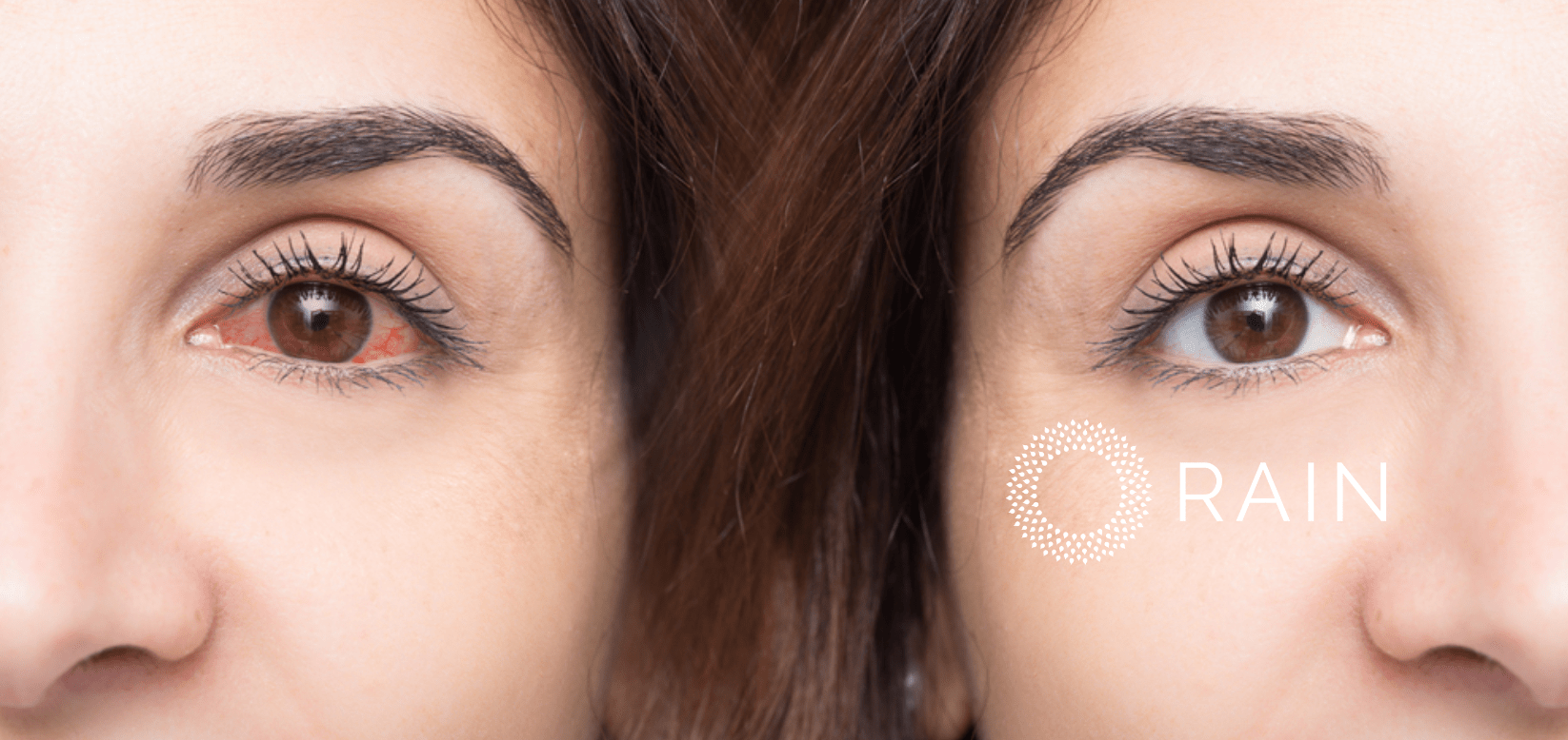 Rain Eye Drops Shares 5 Ways To Care For Dry Eyes During Allergy Season