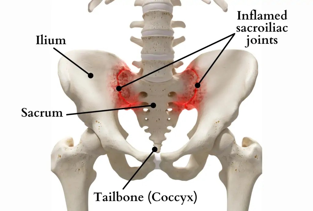 Sacral Bone Pain Causes, Treatment, and Anatomy of Sacrum