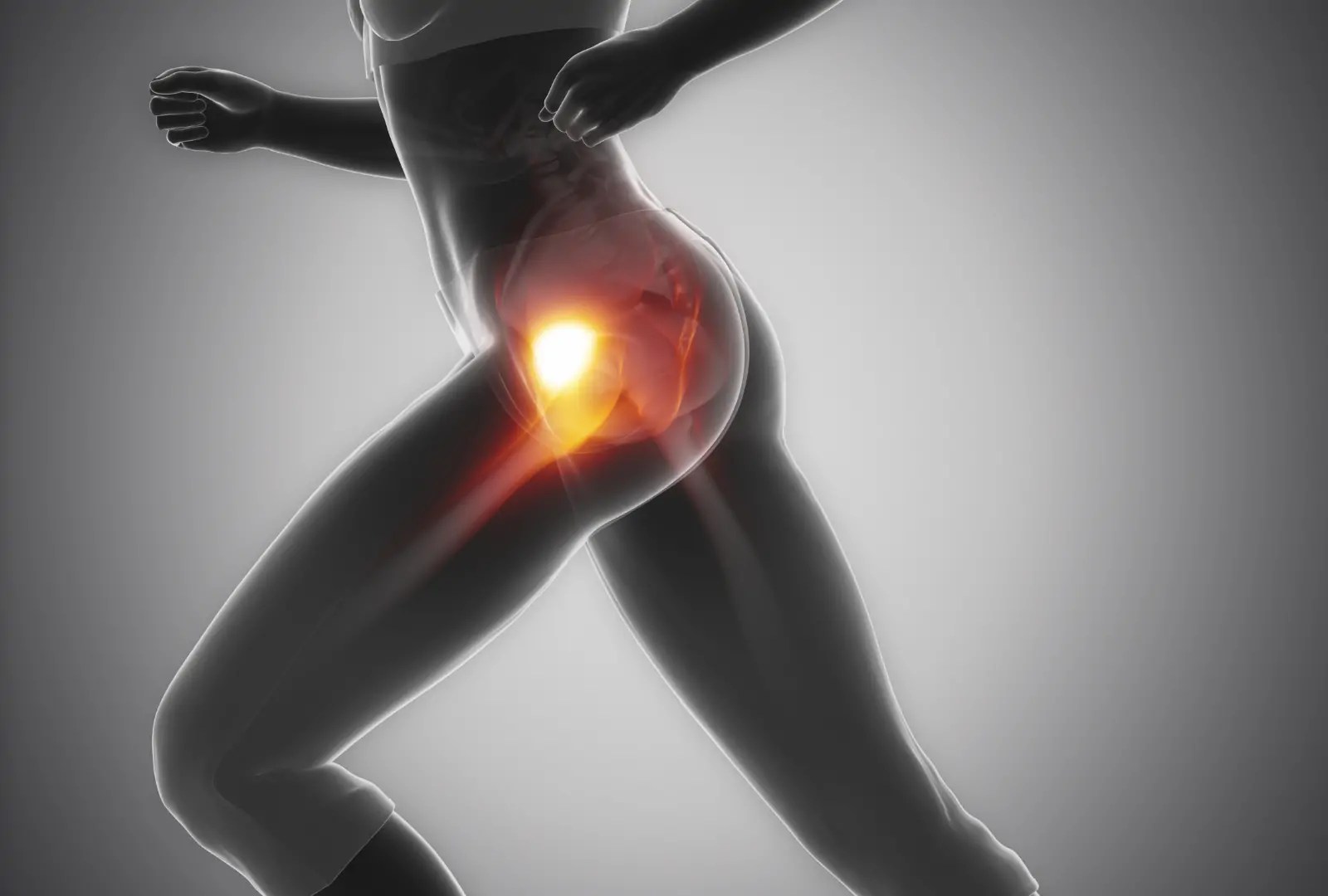 Trapped Nerve in Hip Causes, Symptoms and Treatment