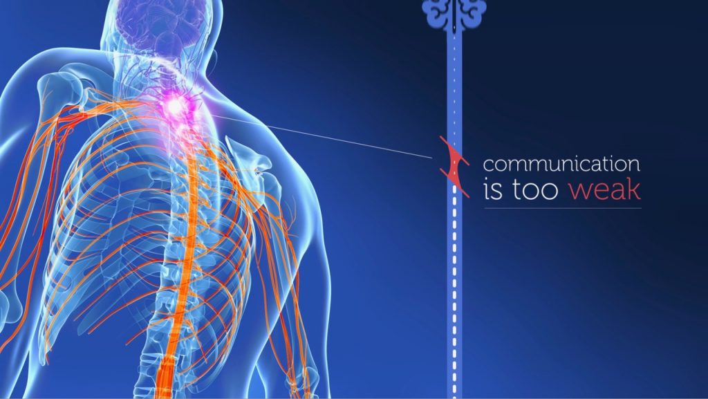 Our neurostimulation funding SpinalCure Australia