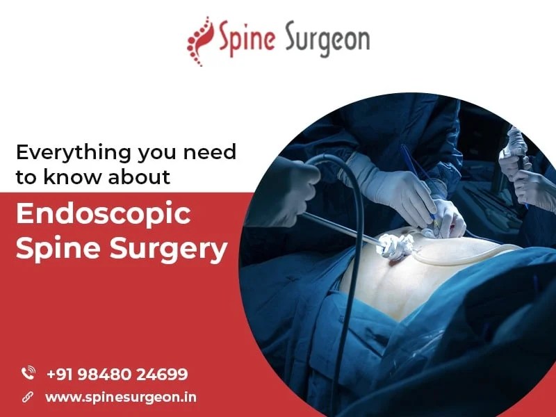 Everything you need to know about Endoscopic Spine Surgery Spine Surgeon