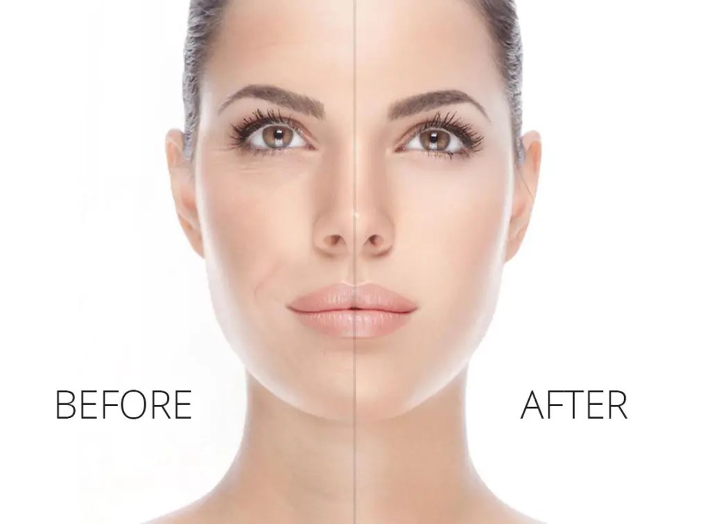 Beautiful Image Microcurrent Facebook