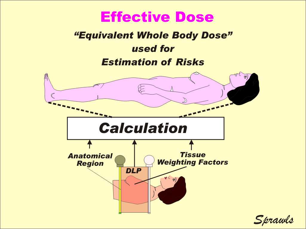Ct Scan Dose Calculator ct scan machine