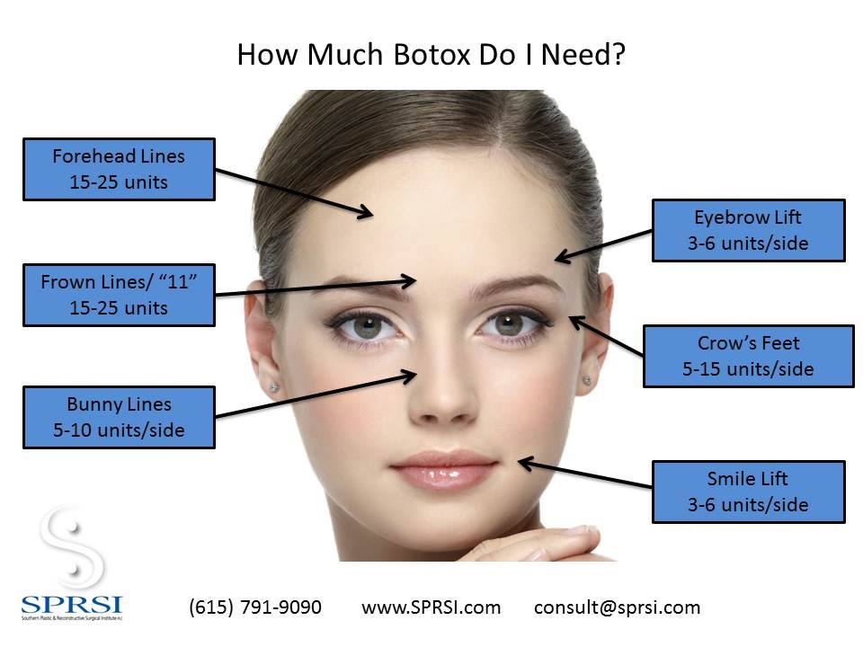 Botox Injections Franklin & Nashville TN Dr. Brought
