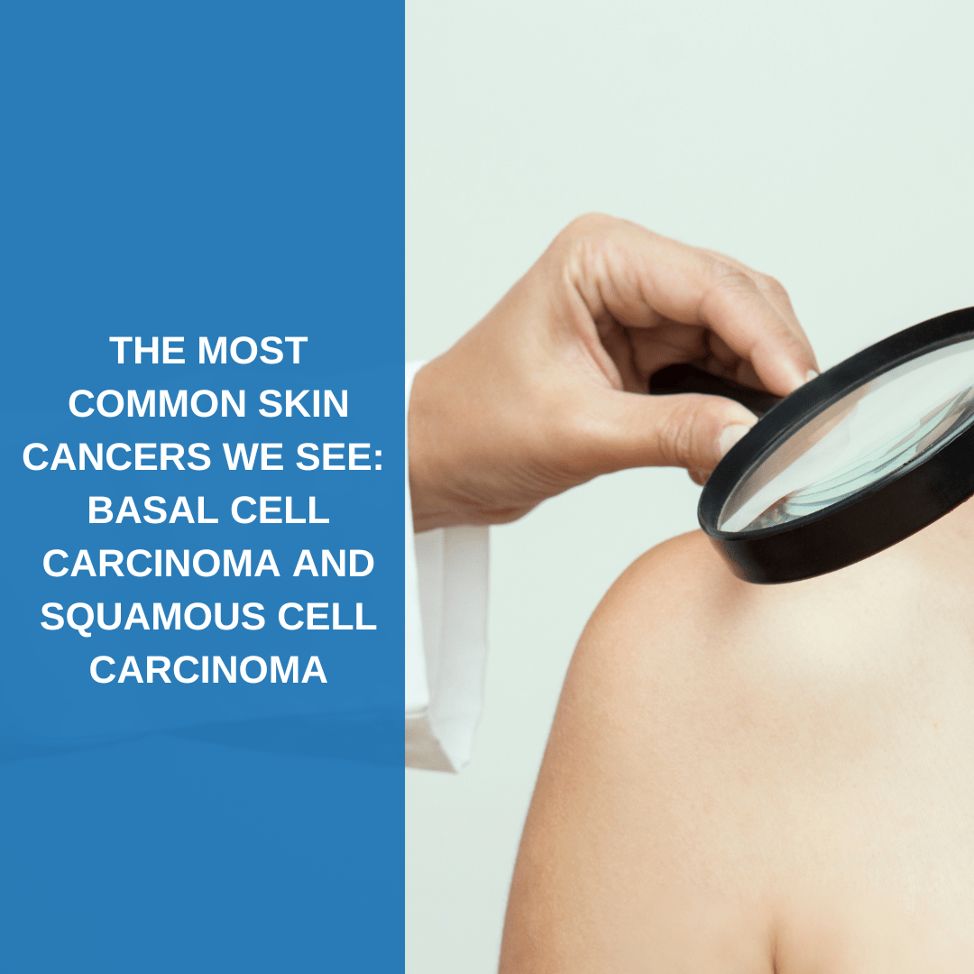 The Most Common Skin Cancers We See An overview of Basal Cell