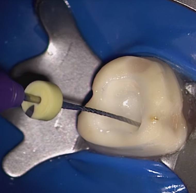 FELLOWSHIP IN ENDODONTICS AND RESTORATIVE DENTISTRY sscdsguide