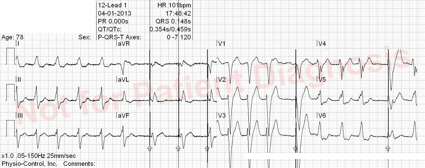 ECG Interpretation 1 ECG Quiz