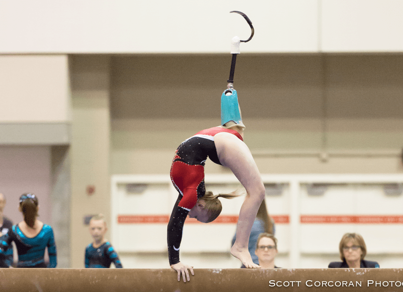 A Balancing Act An Update on Kate Foster