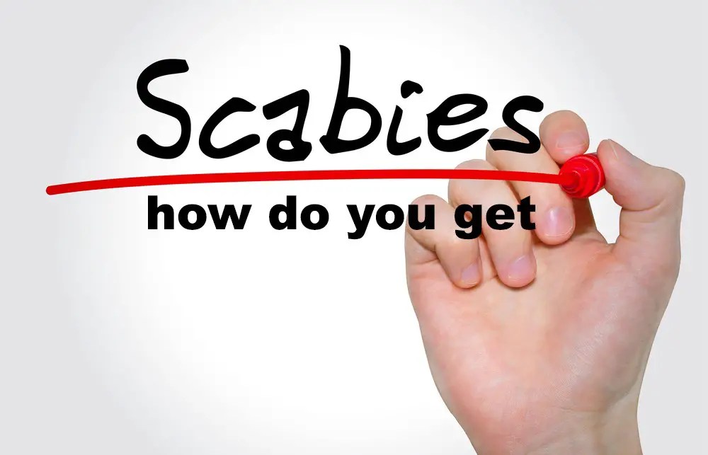 How Do You Get Scabies causes, symptoms, treatment, pictures