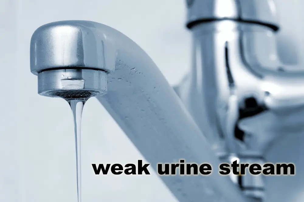 Weak urine stream reasons, treatment, male, female