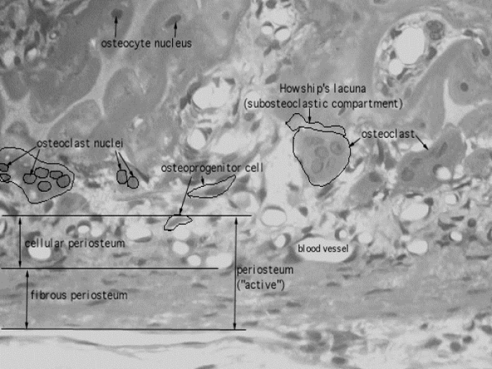 The Periosteum for Regenerating Periodontal Lesions