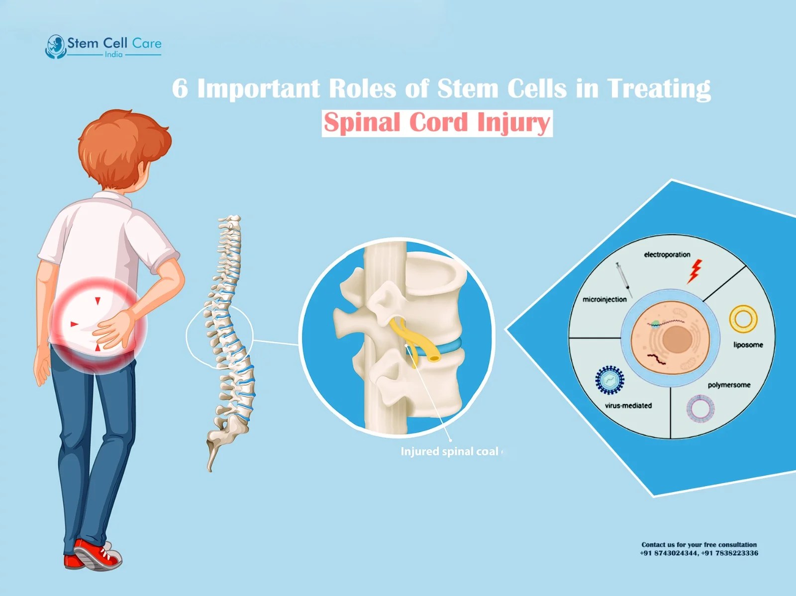 6 Important Roles of Stem Cells in Treating Spinal Cord Injury