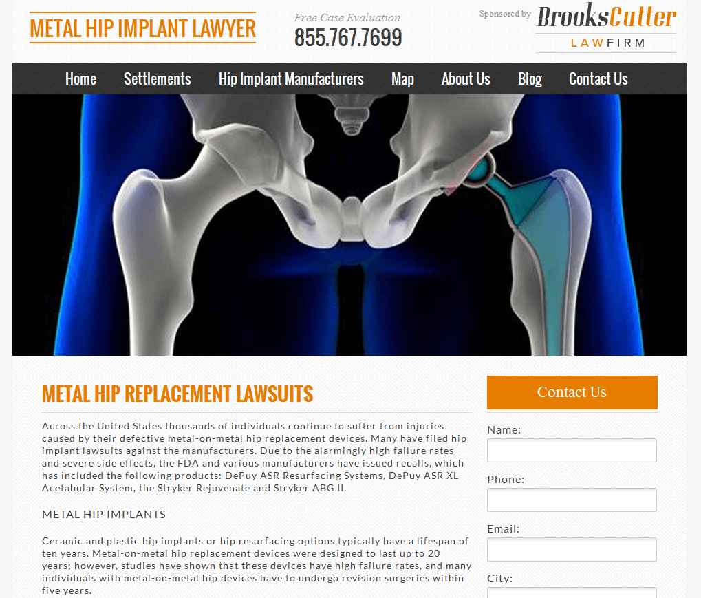 Cutter Law Launches Metal Hip Implant Microsite Stem Legal