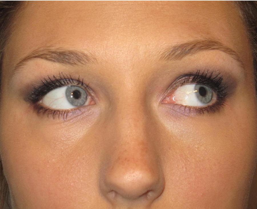 How to Get Eyebrows to Grow How to Get Eyebrows to Grow