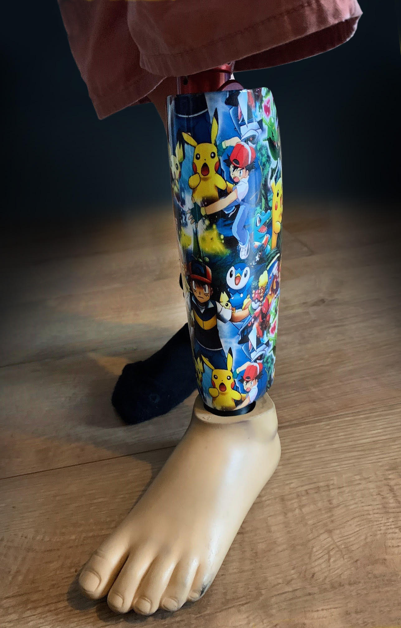 New prosthetic limb covers for children! STEPS Charity