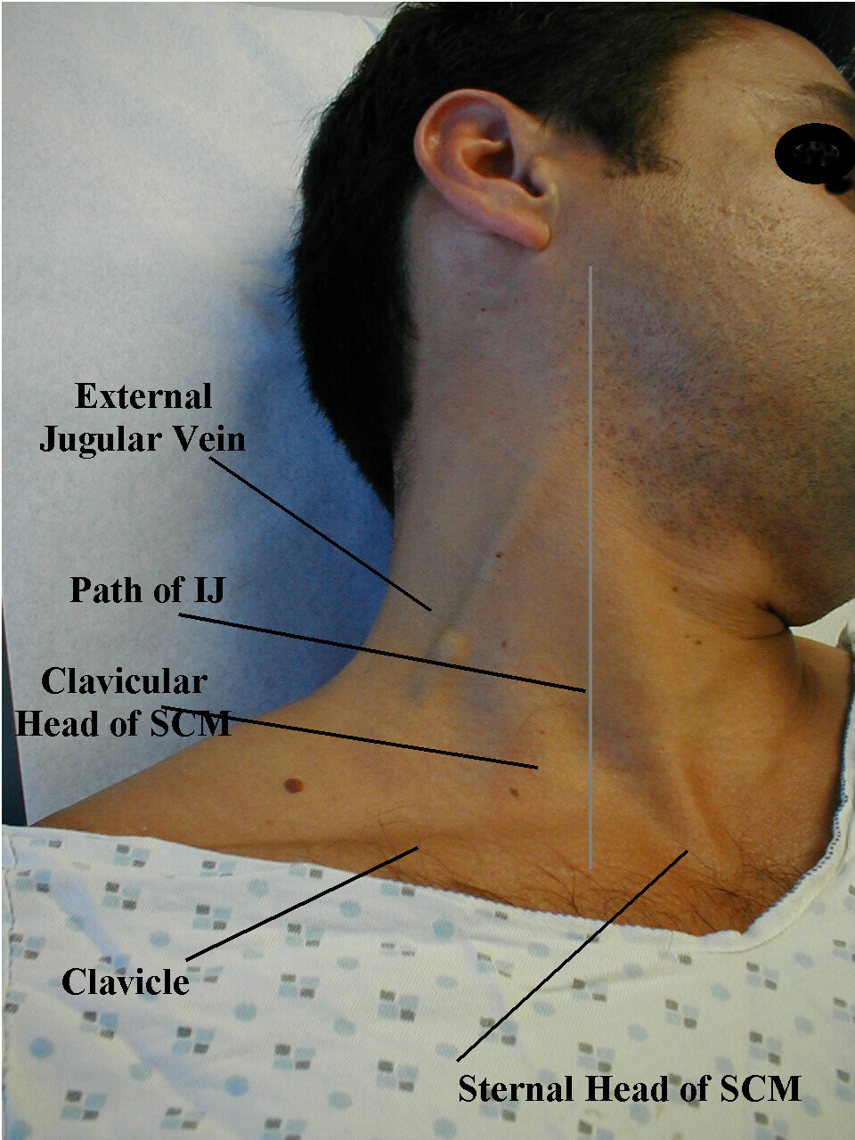 Cardiovascular Exam Stepwards