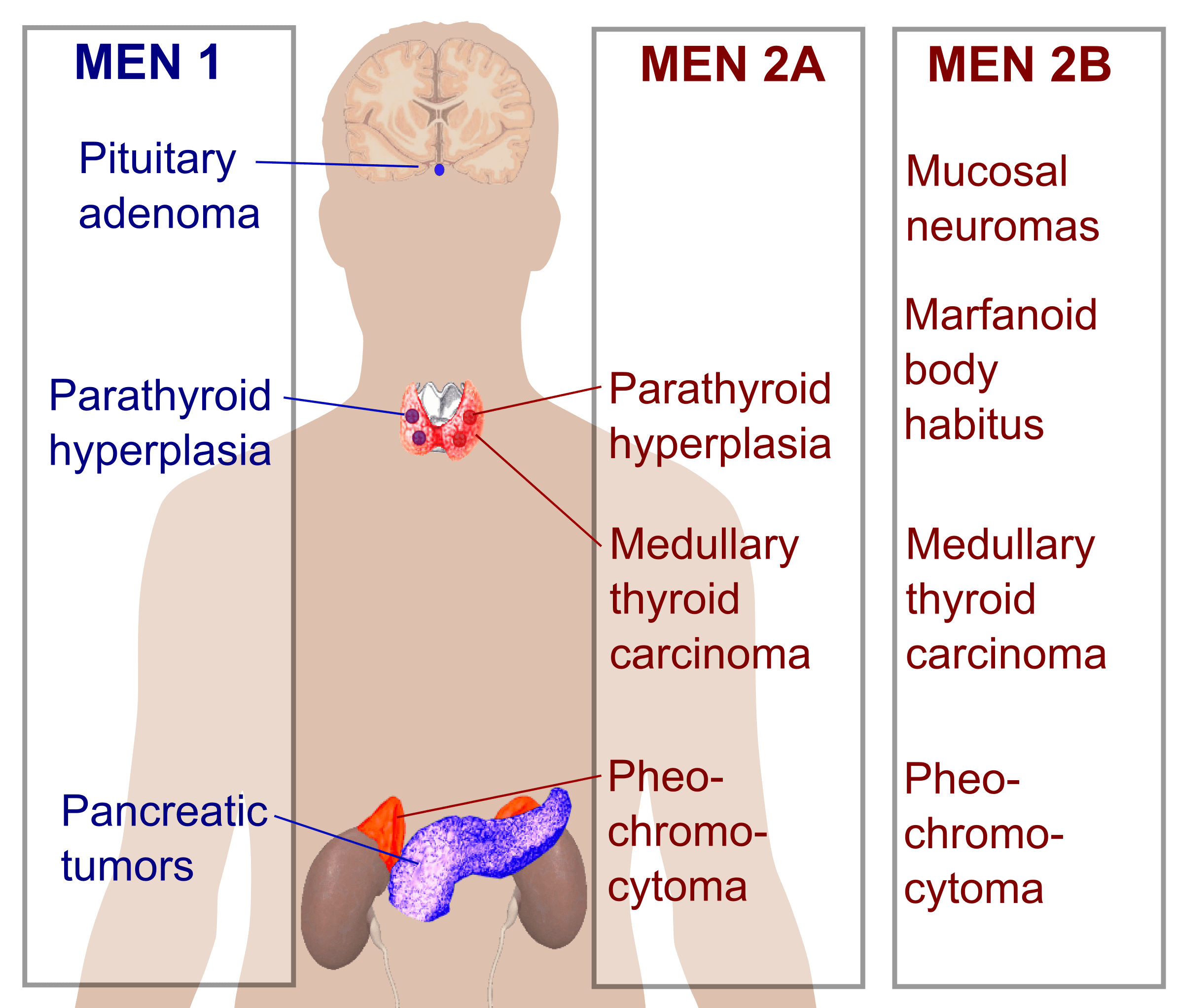MEN1 (Multiple Endocrine Neoplasias) Stepwards