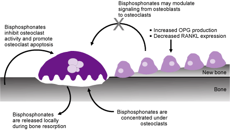 Bisphosphonates Side Effects