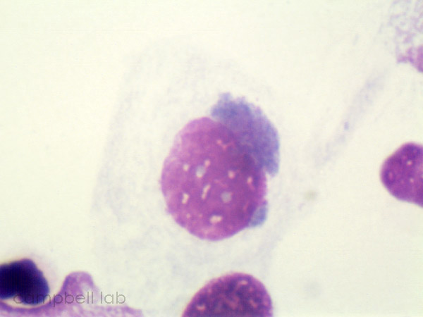 Chlamydia Trachomatis Stepwards