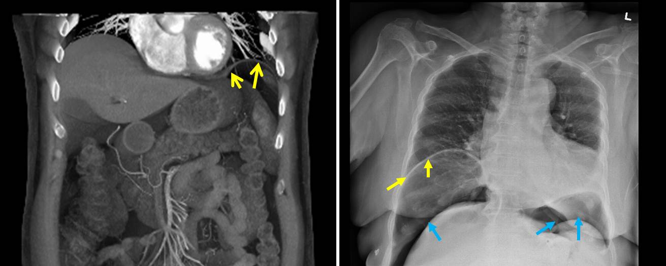 Fundamentals Of Computed Tomography Studies How It Works