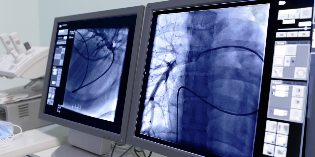 Radiography (B.S.) University of St. Francis