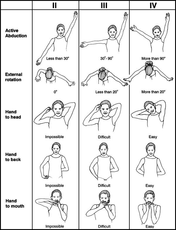 Medical Treatment of Brachial Plexus Palsy St. Louis Children's Hospital
