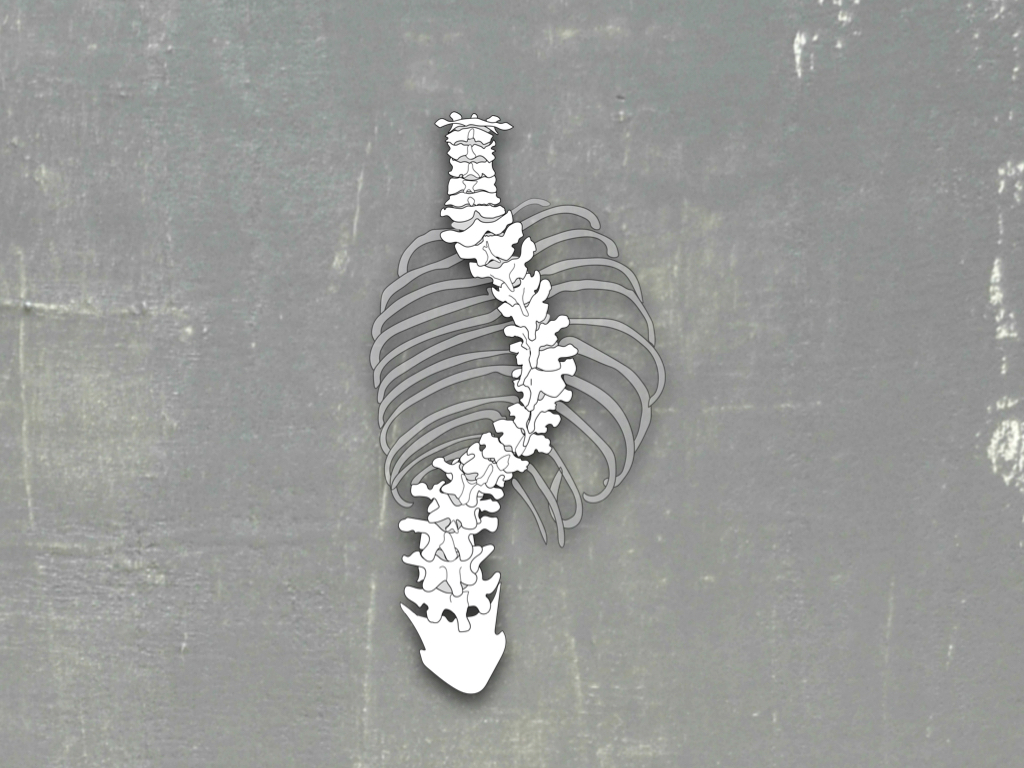Scoliosis Ribs Texture Stolze Therapies