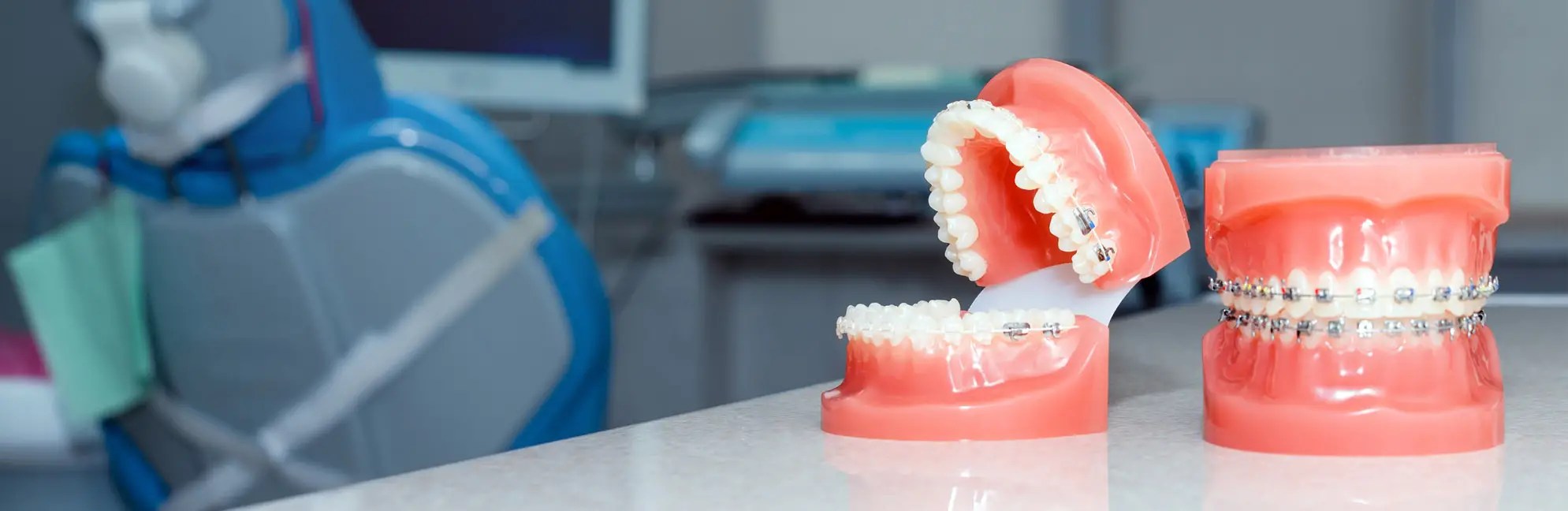 Dental Braces in Las Vegas, NV StoneWater Dentistry