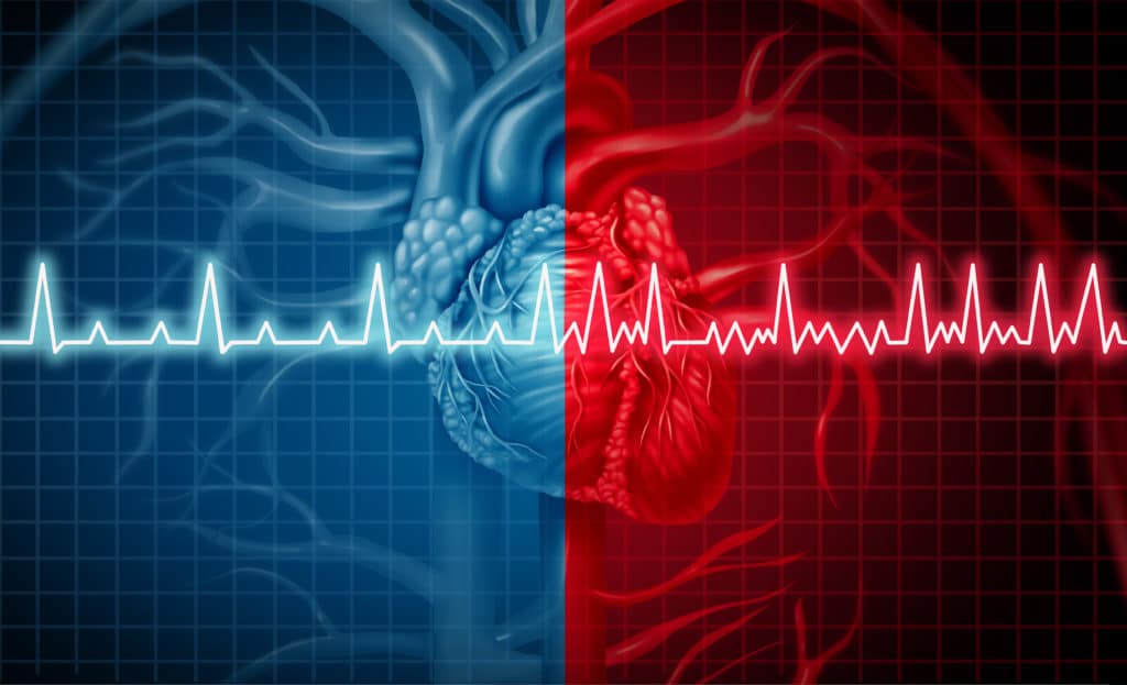 Cardioversion Birmingham AL Electrical Cardioversion