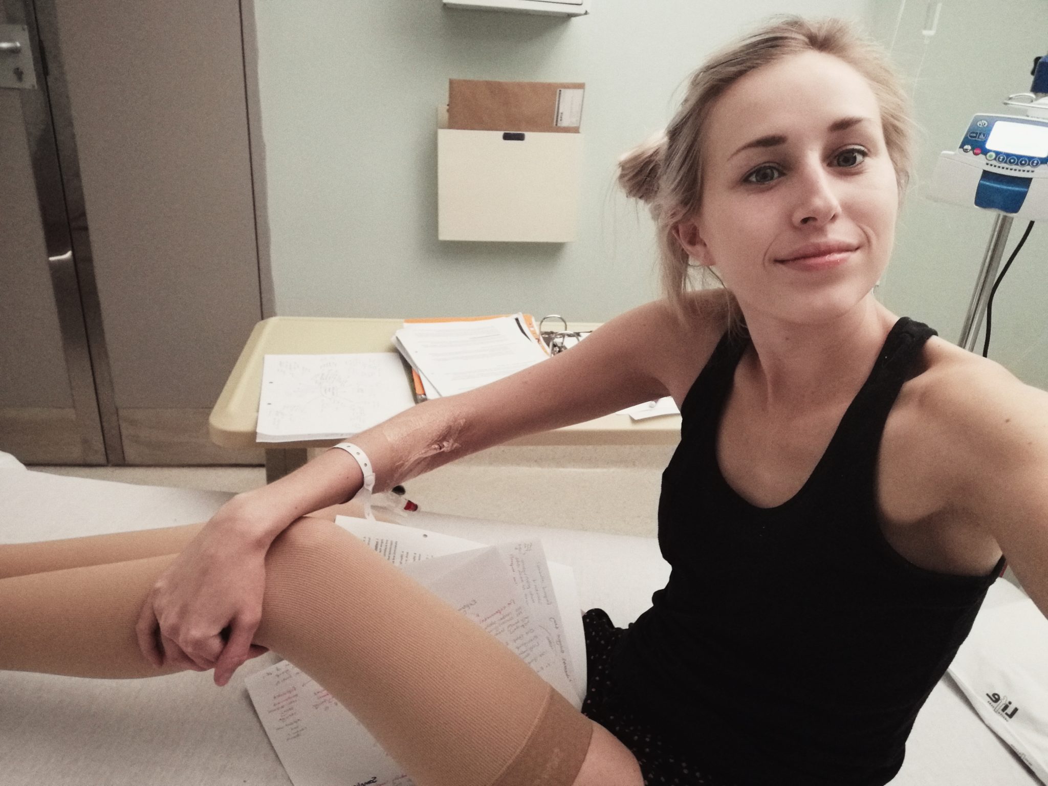 Blood Clot Symptoms From Birth Control Health Facts Hormonal Birth