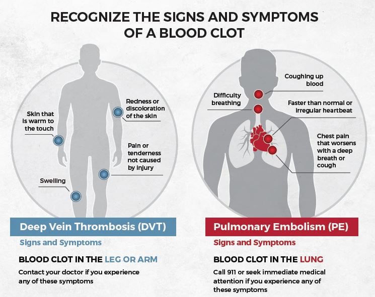 Does Blood Clots Show Up In Blood Work at Daisy Holloway blog