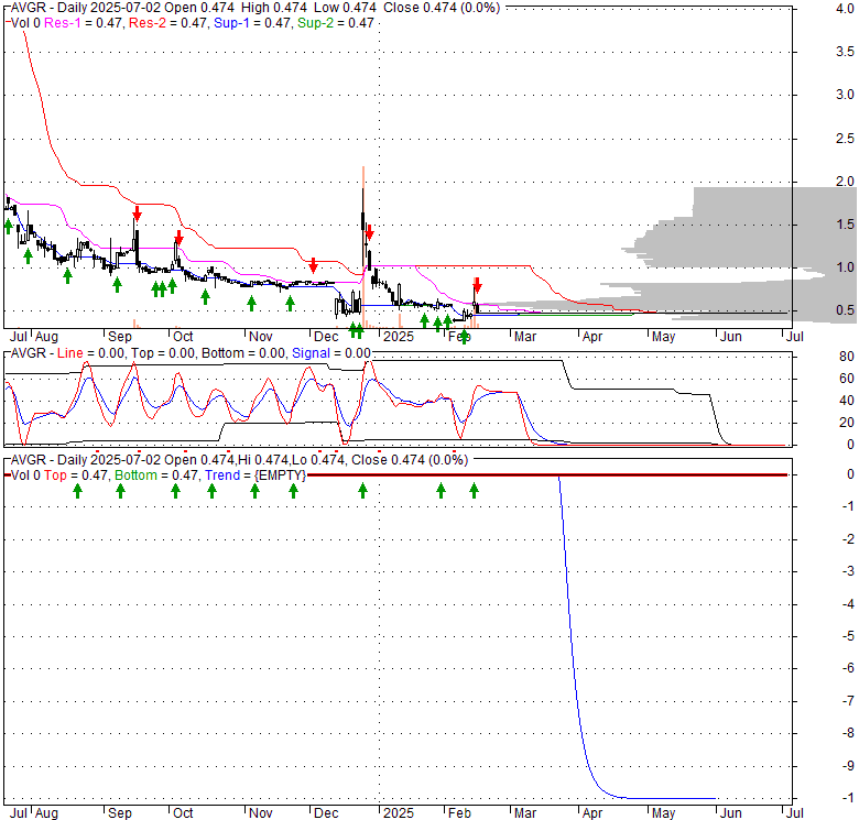 AVGR Avinger, Inc. Stock Quote, Technical Analysis, Rating and News
