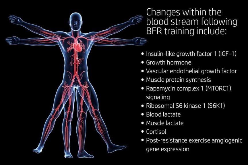 What is Blood Flow Restriction Training? How, Why and When to Use it