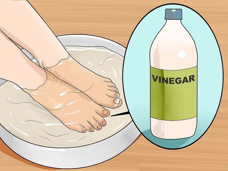 How to Get Rid of Yellow Nails by Home Remedies