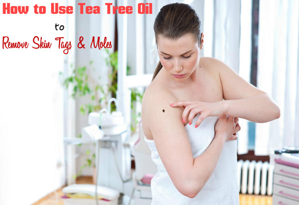 How to Use Tea Tree Oil to Remove Skin Tags & Moles