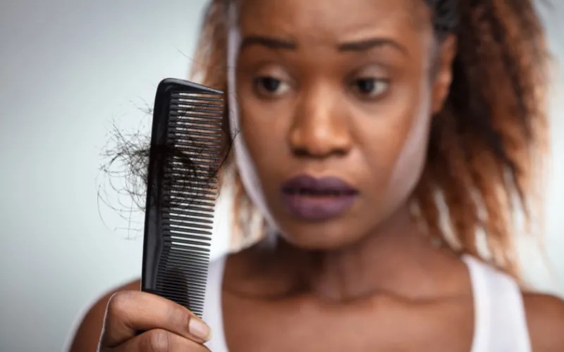 The best black hair products for alopecia