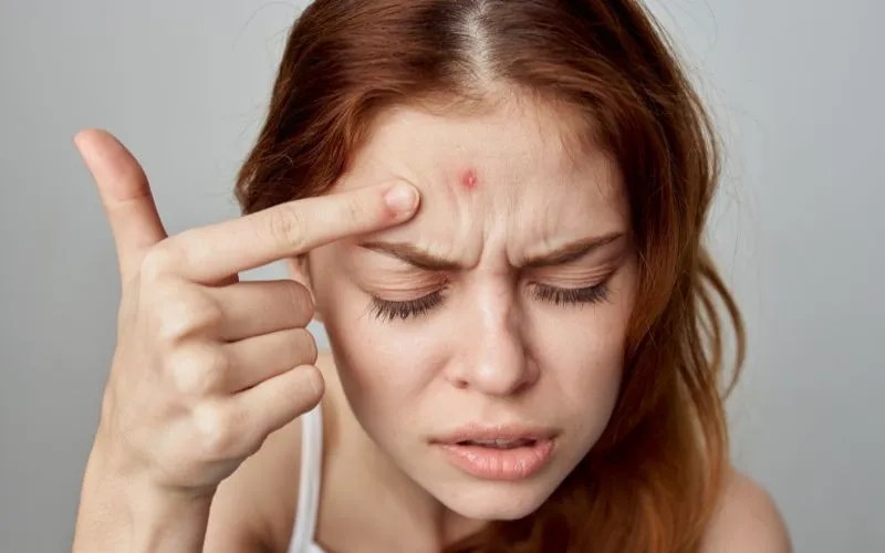 Why Do Pimples Hurt? Causes & Pain Relief Methods Summers Laboratories